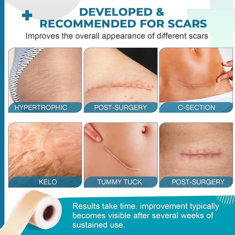 DermaX Scar Tape